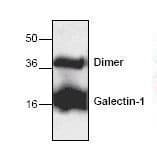 IHC-plus™ LGALS1 / Galectin 1 Antibody