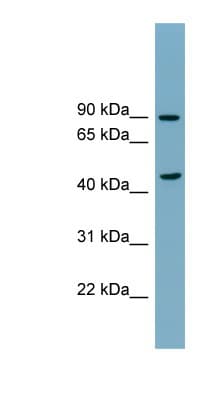 SMPD2 Antibody (N-Terminus)