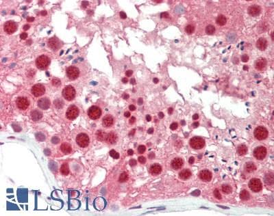 IHC-plus™ STK36 Antibody (aa373-422)