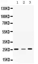 SRI / Sorcin Antibody