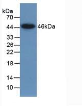 Human LMTK3 Protein (Recombinant His, N-Terminal)