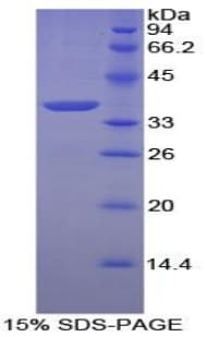 Chicken ANXA5 / Annexin V Protein (Recombinant His)