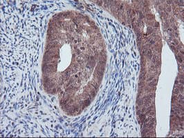 PECR Antibody (clone OTI1F2)