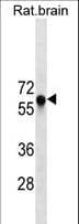 GAD65 Antibody (aa109-138)