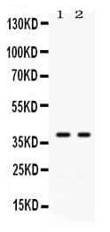 Polyclonal Rabbit anti-Human GAL4 / Galectin 4 Antibody (WB)