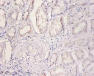 NDUFA2 Antibody