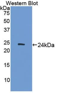ADCY7 / Adenylate Cyclase 7 Antibody (aa309-491)