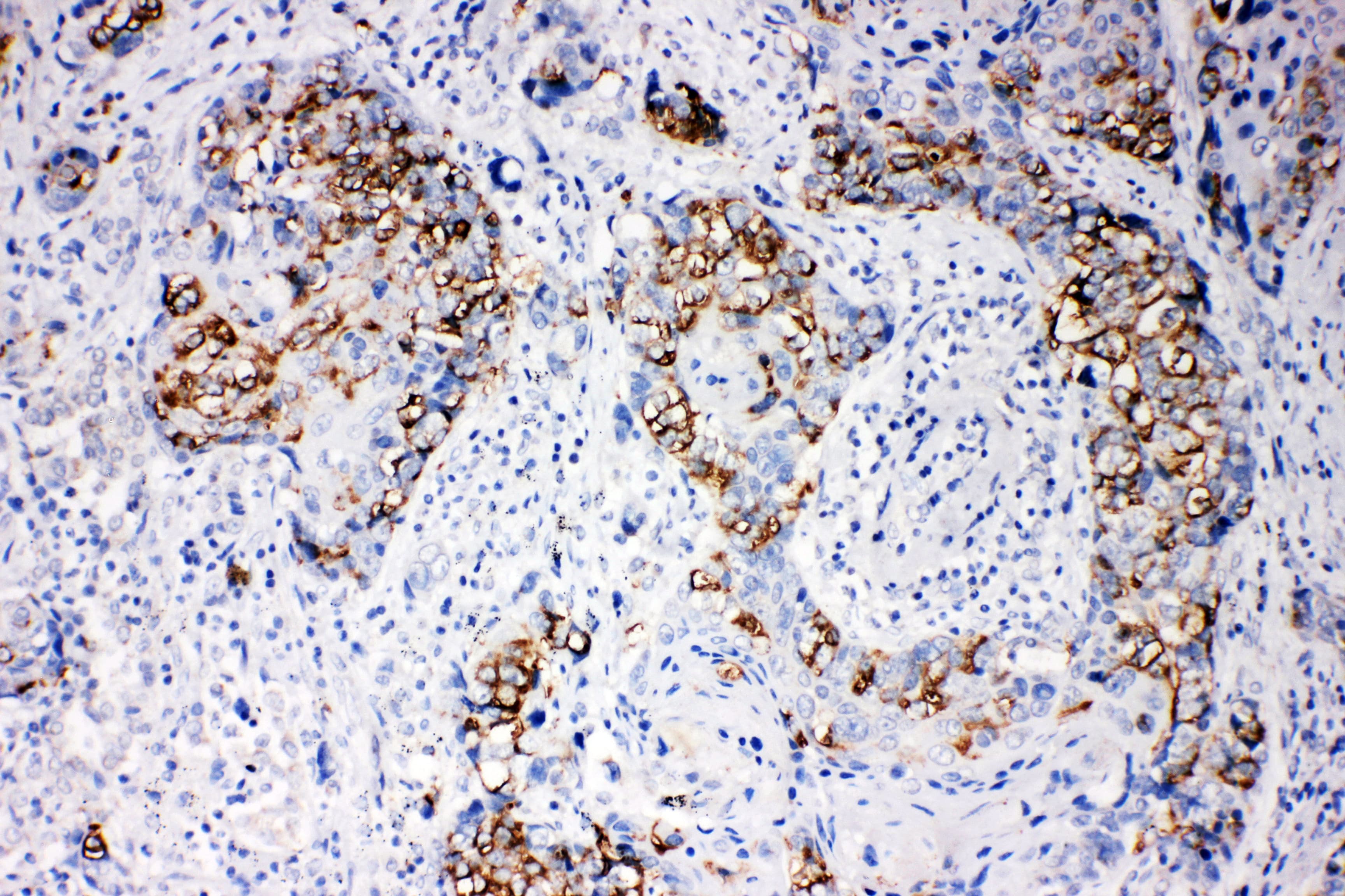 Polyclonal Rabbit anti-Human ARRB1 / Beta Arrestin 1 Antibody (aa82-103, IHC, WB)