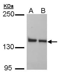 Polyclonal Rabbit anti-Human LRPPRC Antibody (aa611-937, IHC, WB)