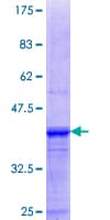 Human SGCG / Gamma-Sarcoglycan Protein (Recombinant GST, N-terminus)