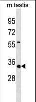 TSTA3 / GDP-L-Fucose Synthase Antibody (aa279-307)