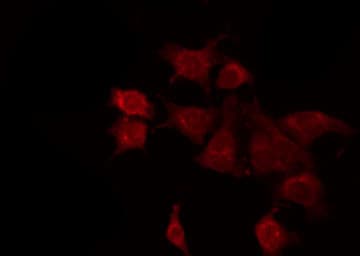 CSTB / Cystatin B / Stefin B Antibody