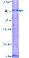 Human SNX8 Protein (Recombinant GST)