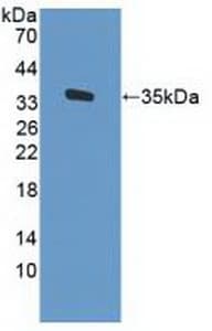 CD34 Antibody (aa32-290, PE)