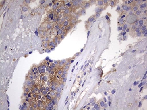 KYNU Antibody (aa1-216, clone OTI1H1)