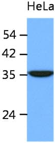 ING2 Antibody (clone AT39E5)