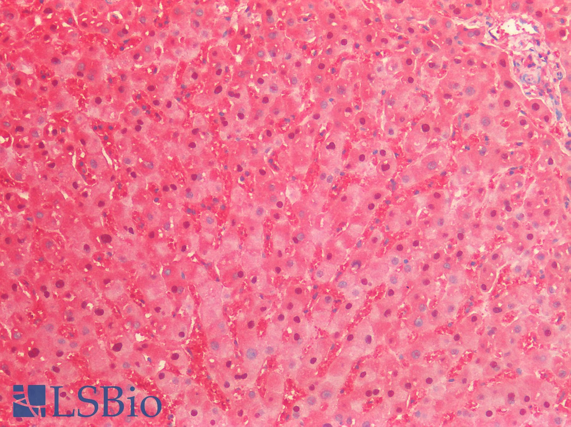 PathPlus™ Polyclonal Rabbit anti-Human ENO1 / Alpha Enolase Antibody (IHC, IF, WB)
