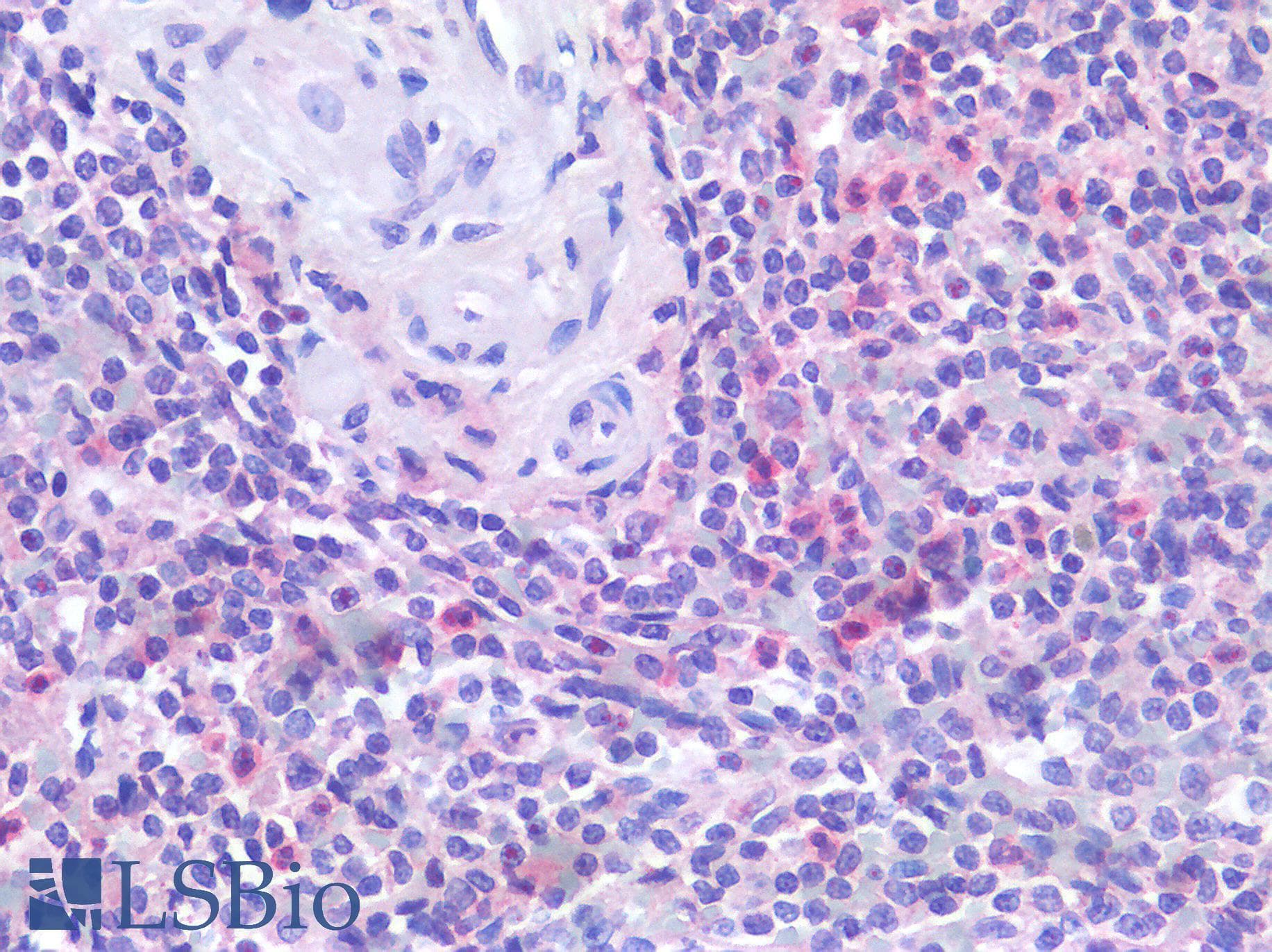IHC-plus™ Polyclonal Rabbit anti-Human IL6R / IL6 Receptor Antibody (IHC)