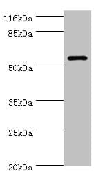 Polyclonal Rabbit anti-Human GK3 / Glycerol Kinase 3 Antibody (IHC, WB)