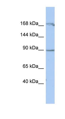 Polyclonal Rabbit anti-Human NARG1 / NAA15 Antibody (aa323-372, WB)