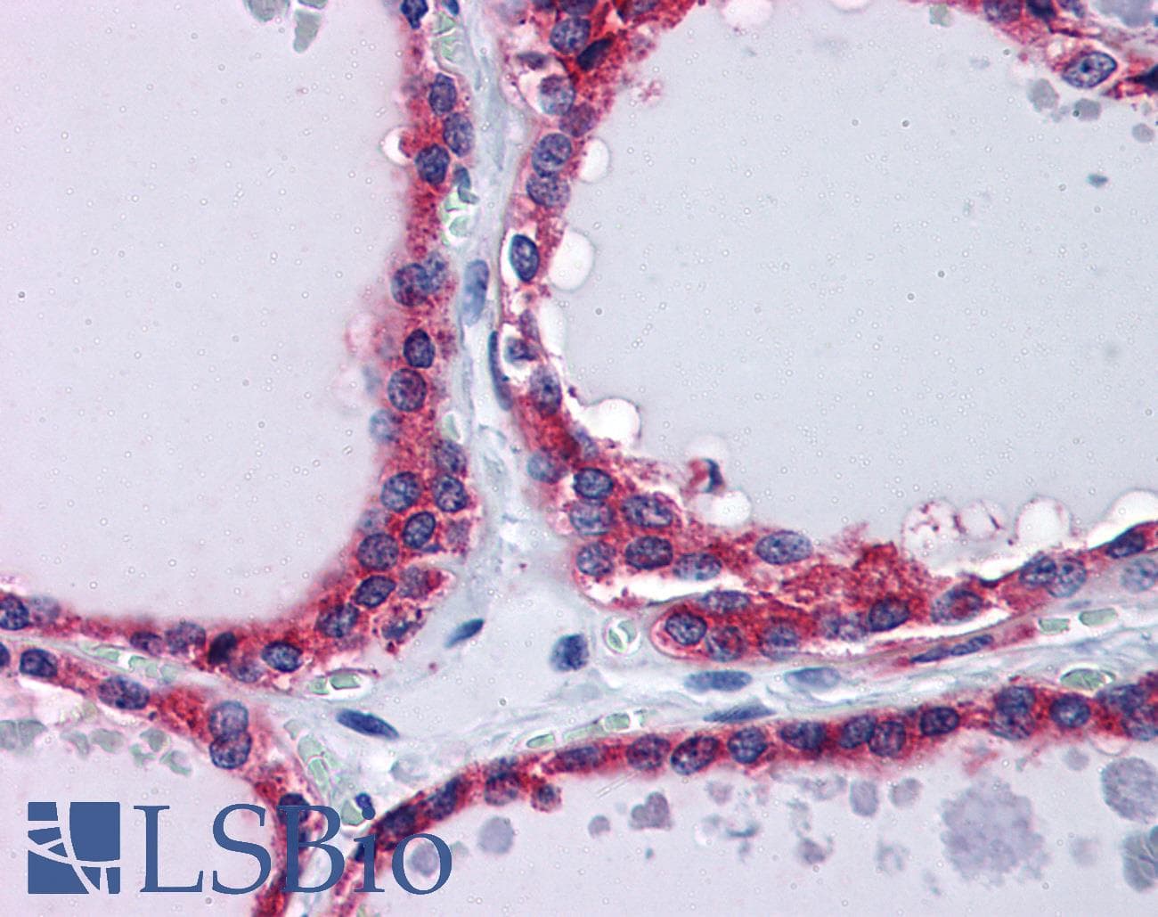 IHC-plus™ PLIN3 / M6PRBP1 / TIP47 Antibody (clone 2F7)