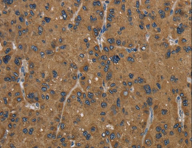 Polyclonal Rabbit anti-Human HSD17B2 Antibody (IHC)