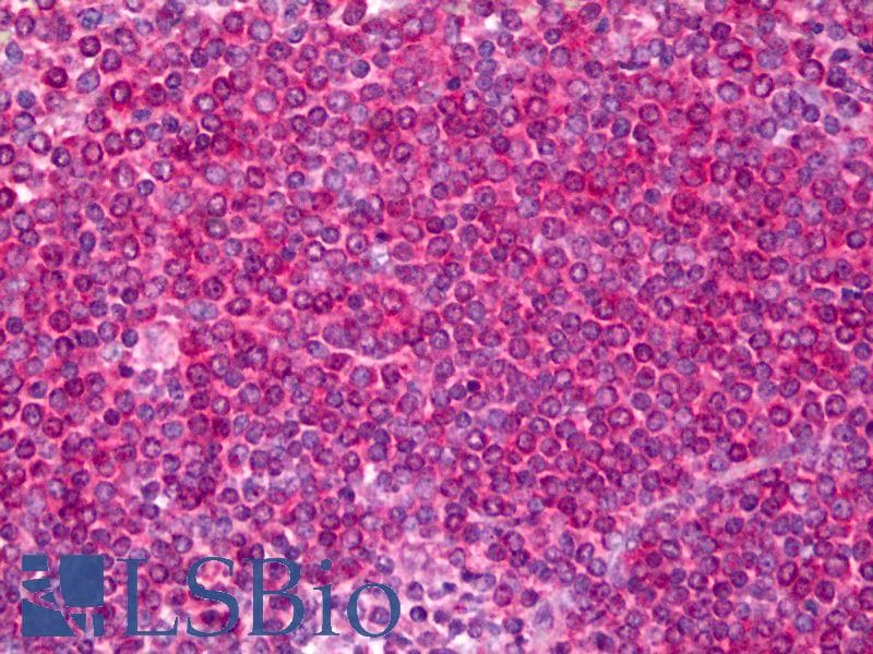 IHC-plus™ Leukotriene B4 Receptor / BLT1 Antibody