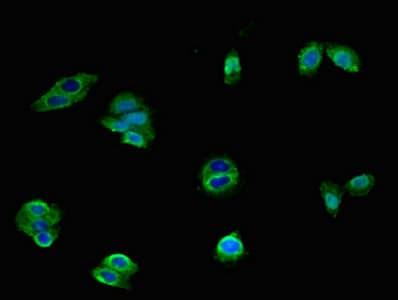 HTR1A / 5-HT1A Receptor Antibody