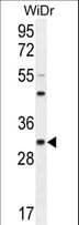 Polyclonal Rabbit anti-Human RILPL2 Antibody (aa120-149, IHC, WB)