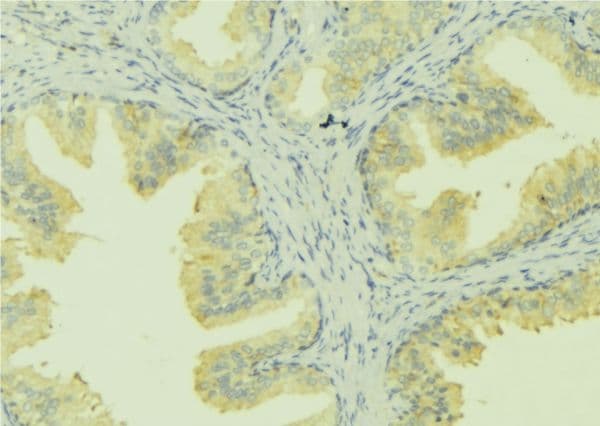 Polyclonal Rabbit anti-Human SLC30A6 Antibody (IHC, WB)