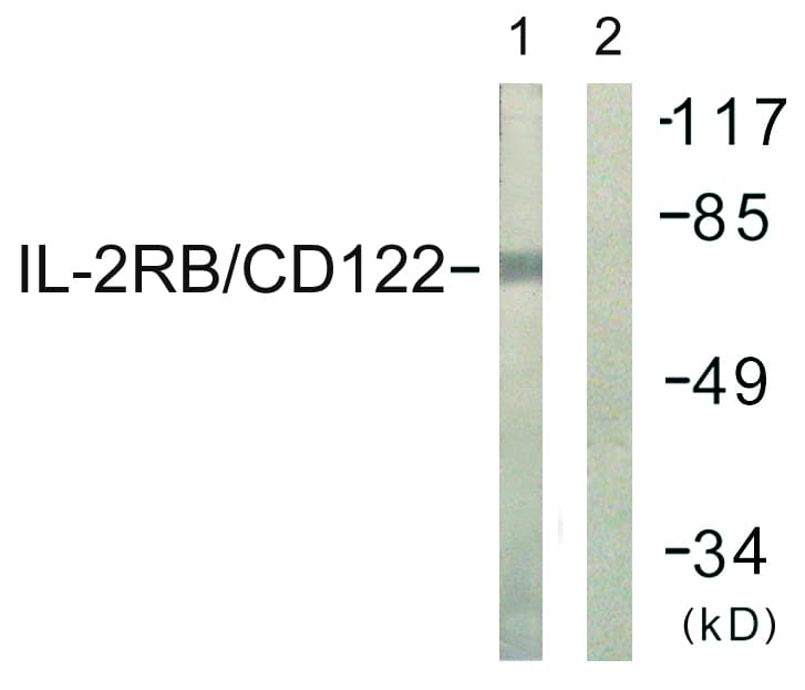 IHC-plus™ IL2RB / CD122 Antibody (aa331-380)