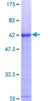 Human CD40 Protein (Recombinant GST)