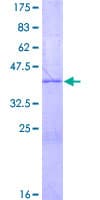 Human NRN1L Protein (Recombinant GST)