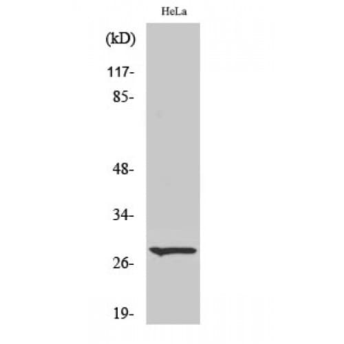 ITGA6/Integrin Alpha 6/CD49f Antibody (900-980 aa, C-terminal)