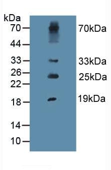 Procollagen III N-Terminal Propeptide Antibody (APC)