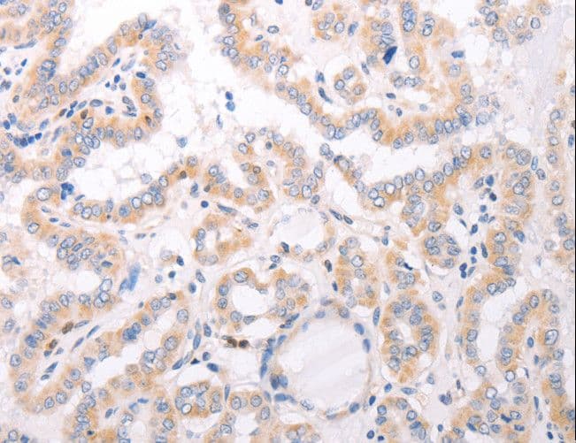 CIDEB Antibody