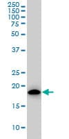 Monoclonal Mouse anti-Human ARF5 Antibody (clone 1B4, IF, WB)