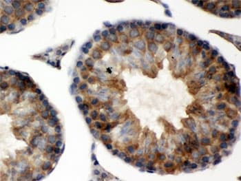 Polyclonal Rabbit anti-Human TCP1 Antibody (IHC, WB)