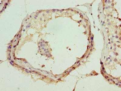 Polyclonal Rabbit anti-Human DDX55 Antibody (IHC)