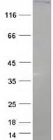 Human PXDN / MG50 Protein (Recombinant Myc-DDK (Flag))