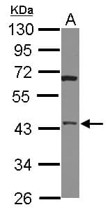 Polyclonal Rabbit anti-Human HTRA3 Antibody (WB)