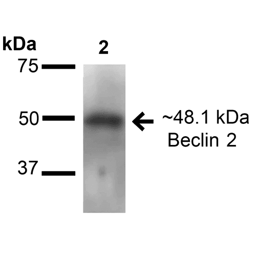 BECN2 Antibody (RPE)