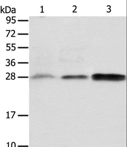 ABH2 / ALKBH2 Antibody