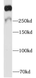 MKI67 / Ki67 Antibody