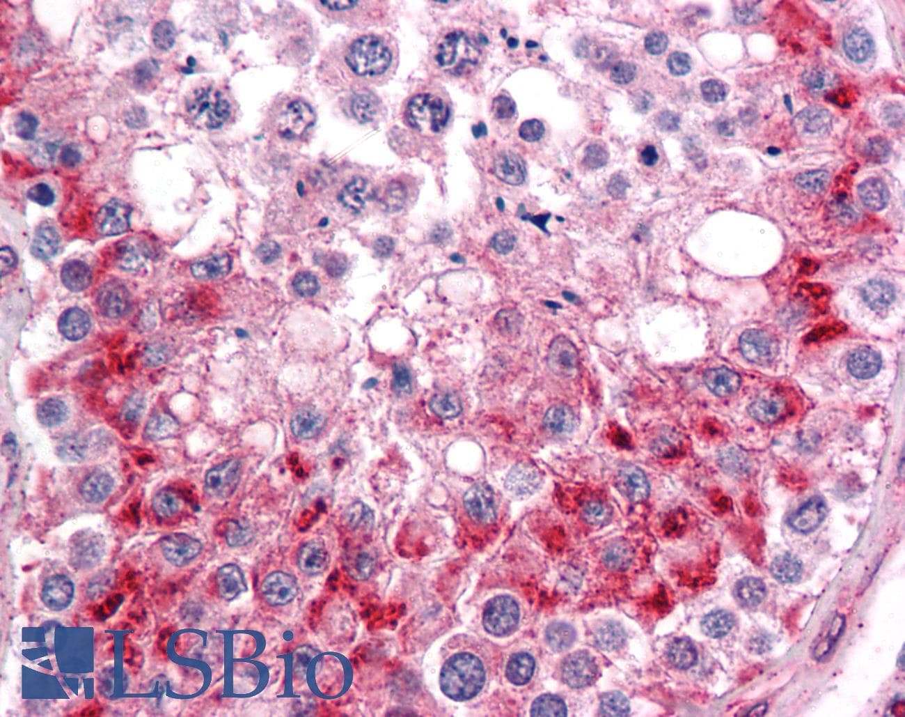 IHC-plus™ TLN1 / Talin 1 Antibody (clone 1A11)