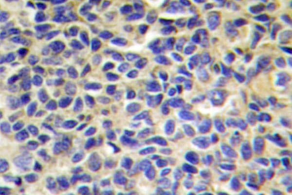 Polyclonal Rabbit anti-Human ARTS1 / ERAP1 Antibody (Lys467, IHC, IF, WB)