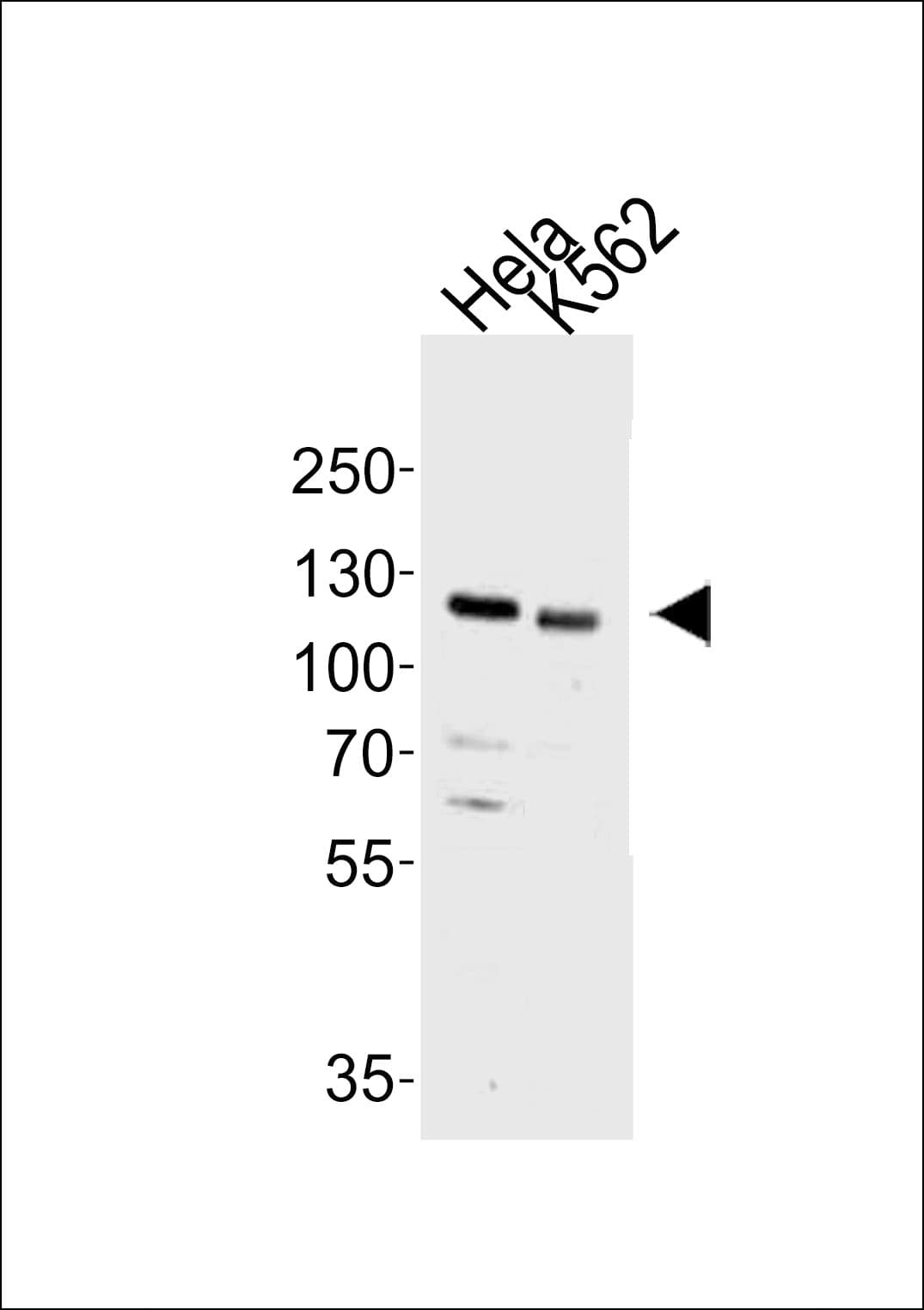 HDAC9 Antibody