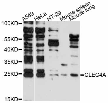 Polyclonal Rabbit anti-Human CLECSF6 / DCIR Antibody (IHC, WB)
