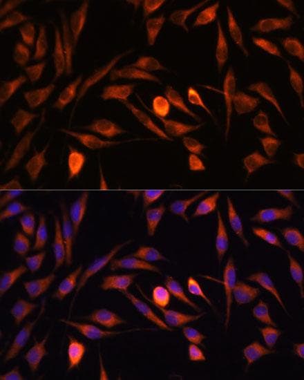 Polyclonal Rabbit anti-Human PTCD1 Antibody (IF)