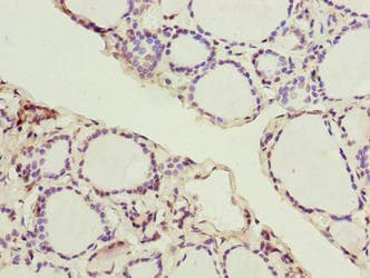 Polyclonal Rabbit anti-Human SLC52A1 / GPR172B / PAR2 Antibody (IHC)